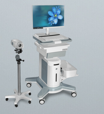 陰道鏡檢查是什么