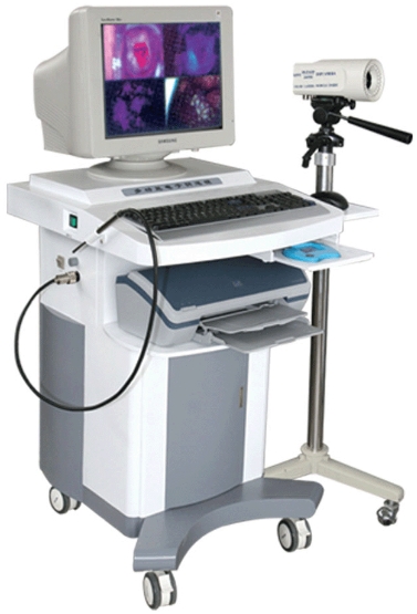 電子陰道鏡：女性健康，私密檢查的得力助手