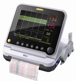 胎兒監(jiān)護的便捷時代：超聲技術(shù)如何守護母嬰健康