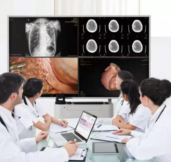 遠(yuǎn)程醫(yī)療影像會診：跨越地域的醫(yī)療智慧共享