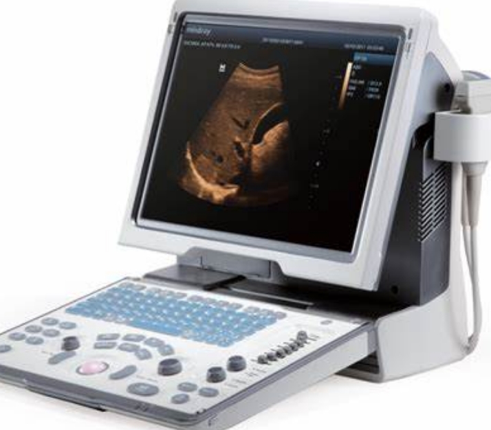超聲診斷的便攜化革命：隨時(shí)隨地，精準(zhǔn)醫(yī)療觸手可及