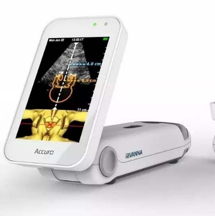 超聲引導(dǎo)穿刺的智能化：精準(zhǔn)定位，提升手術(shù)安全性