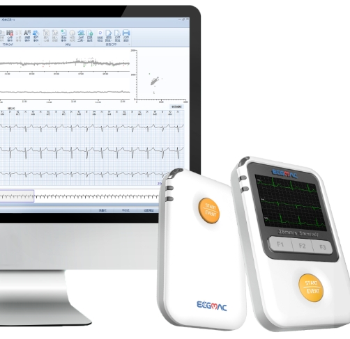 遠(yuǎn)程心電監(jiān)測(cè)的智能化：精準(zhǔn)分析，守護(hù)心臟健康