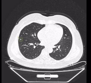 透視生命，洞悉健康：詳解醫(yī)學影像處理軟件的革新應用