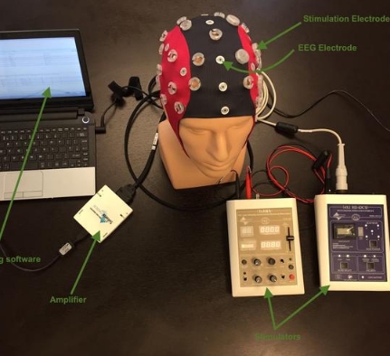 無(wú)創(chuàng)腦部監(jiān)測(cè)新工具：腦電圖（EEG）頭盔的技術(shù)進(jìn)展與應(yīng)用