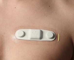 無創(chuàng)心臟監(jiān)測的新突破：可穿戴心電圖貼片的技術(shù)特點與應用場景