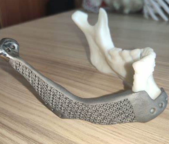 個性化骨科治療的突破：3D打印骨移植材料的應用與發(fā)展