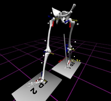 智能康復(fù)訓(xùn)練的創(chuàng)新：虛擬現(xiàn)實(shí)結(jié)合步態(tài)分析系統(tǒng)的功能與潛力