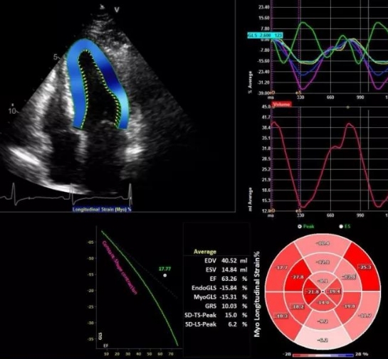 無創(chuàng)心臟成像的新選擇：實(shí)時(shí)三維超聲心動(dòng)圖設(shè)備的功能與優(yōu)勢(shì)