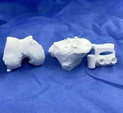 個(gè)性化骨科治療的創(chuàng)新：3D打印定制化骨板的應(yīng)用與發(fā)展