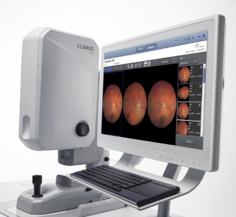 精準(zhǔn)眼科診斷的未來：超廣角眼底血管成像系統(tǒng)的臨床應(yīng)用與優(yōu)勢