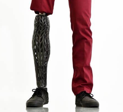 3D打印假肢：個(gè)性化解決方案的新時(shí)代