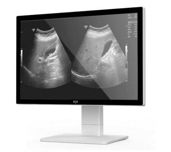 AI輔助診斷系統(tǒng)提高疾病檢測(cè)的準(zhǔn)確性和速度