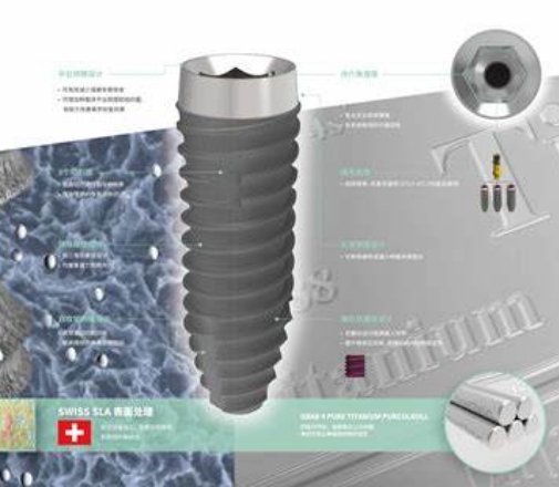 種植系統(tǒng)：全面解決方案的人工牙齒種植系統(tǒng)，促進(jìn)口腔健康恢復(fù)