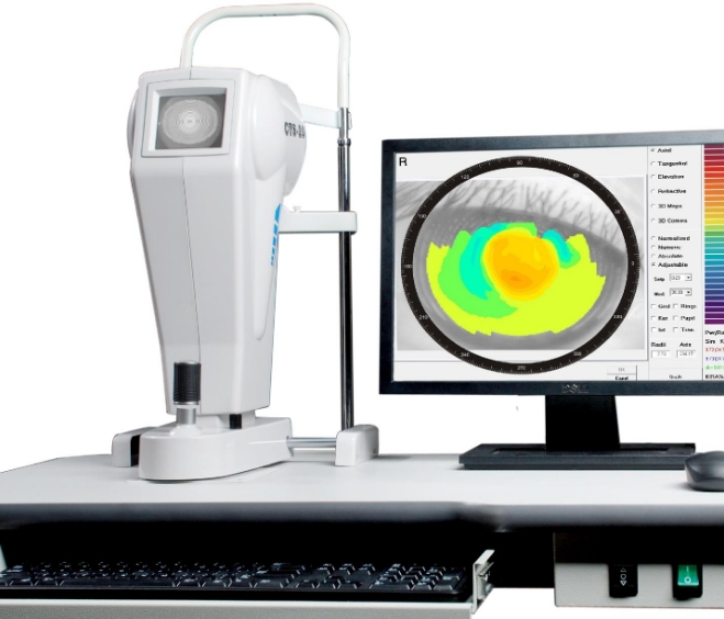 角膜地形圖儀：繪制角膜地圖，精確指導(dǎo)治療——角膜地形圖儀的功能詳解