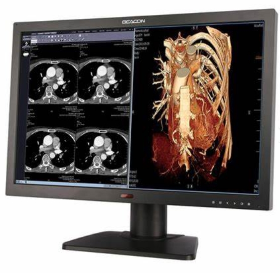 高清顯示，精確診斷——醫(yī)用顯示器的技術(shù)特點(diǎn)及其重要性