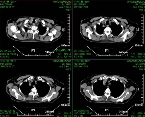 數(shù)字化影像管理——PACS系統(tǒng)如何優(yōu)化醫(yī)療圖像存儲與交流