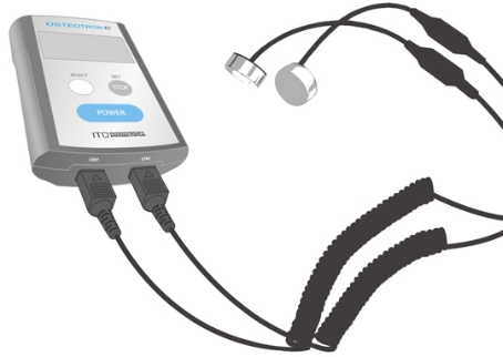 骨折愈合監(jiān)測儀