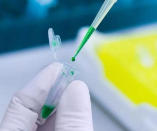 前列腺癌特異性抗原檢測(cè)儀?