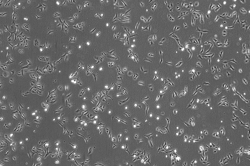 (U2OS&nbsp;細胞)放大倍率：40×，相差